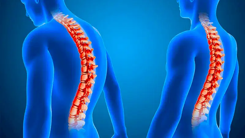 Degenerative Disc Disease: Causes, Symptoms and Treatment Methods
